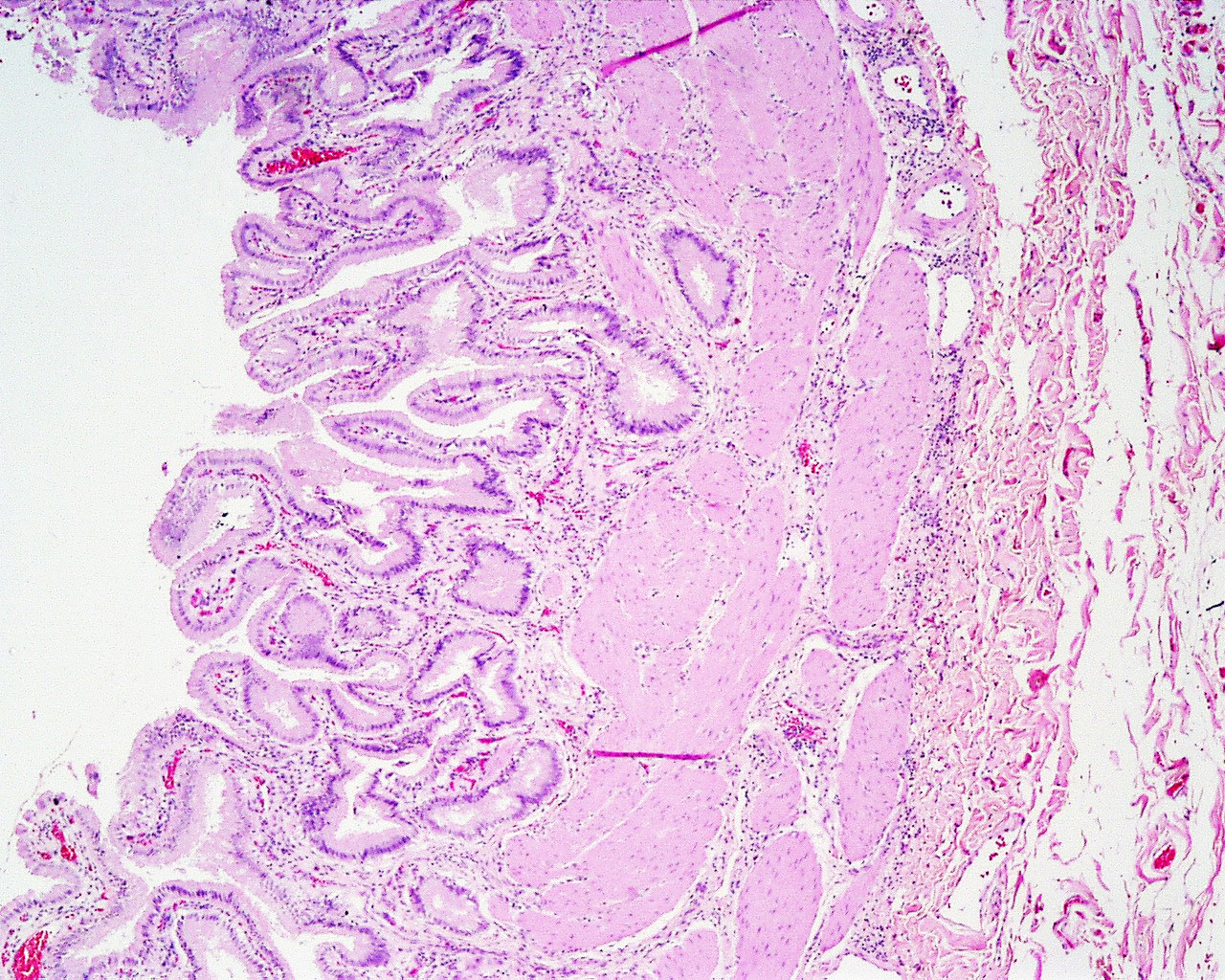 Hematoloogia ja histoloogia