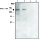 ANTI-ATP13A2 (C-TERMINAL REGION) ~1.5 mg/mL, affinity isolated antibody, buffered aqueous solution,