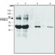 ANTI-PIP5K1C (C-TERMINAL) ~1.5 mg/mL, affinity isolated antibody, buffered aqueous solution,