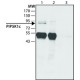 ANTI-PIP5K1C (N-TERMINAL) ~1 mg/mL, affinity isolated antibody, buffered aqueous solution,