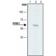 ANTI-PINK1 (N-TERMINAL) ~1.5 mg/mL, affinity isolated antibody, buffered aqueous solution,