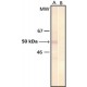 Monoclonal Anti-Phosphoserine antibody produced in mouse, clone PSR-45, ascites fluid,