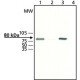 ANTI-GRK2 affinity isolated antibody, buffered aqueous solution,