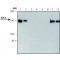 ANTI- EDC4 (C-TERMINAL), ANTIBODY PRODU&