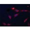 ANTI-CORONIN-1C (C-TERMINAL), ANTIBODY &