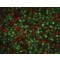 RABBIT ANTI-HUMAN T CELL CD3 PEPTIDE